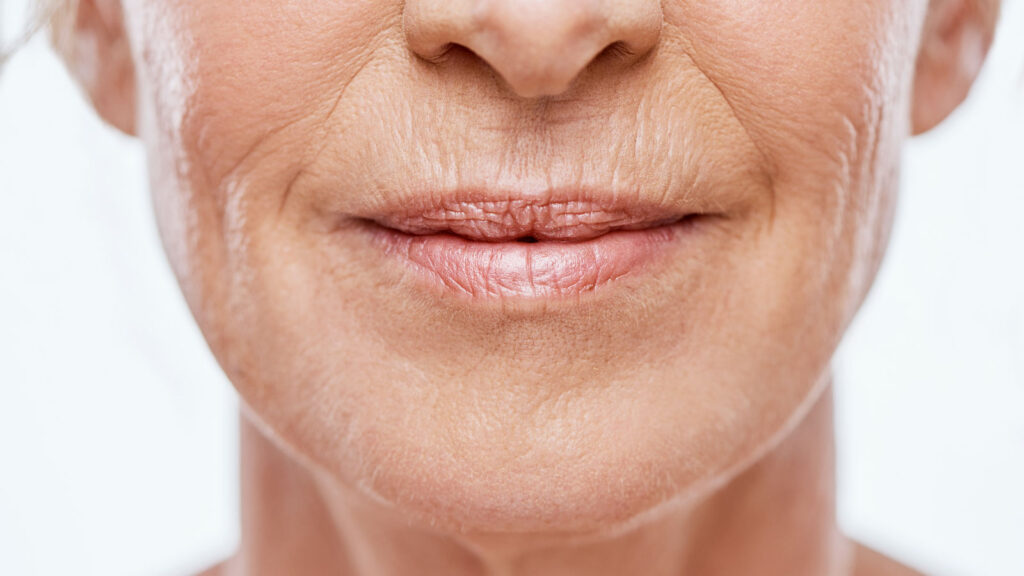 Botox-Mood-Psychology-Ageing