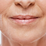 Botox-Mood-Psychology-Ageing
