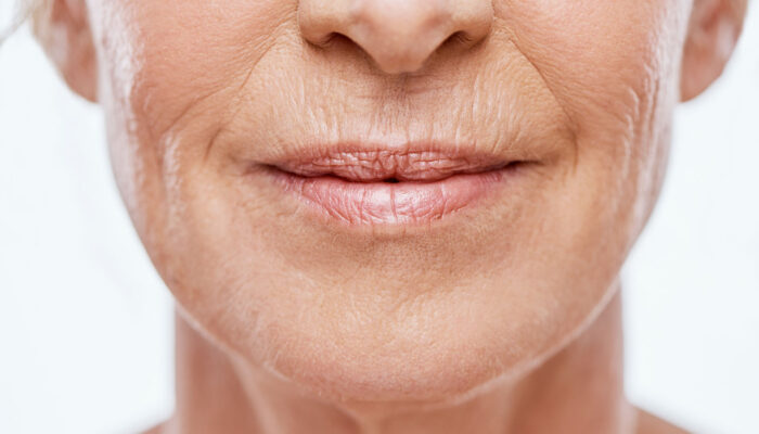 Botox-Mood-Psychology-Ageing